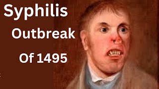 Syphilis Outbreak 1495  Europe pandemic [upl. by Jessey112]