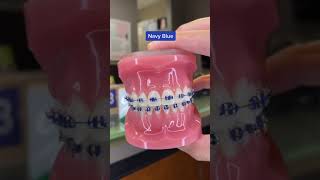 Braces Colors to have your Teeth look Whiter  Dr Bar The Braces Doc [upl. by Hurty]