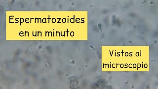 Espermatozoides al microscopio aumentados 400 veces [upl. by Annenn825]