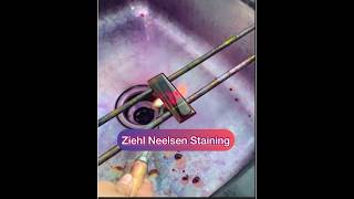 Ziehl Neelsen stainingZN stainingAFB staining Afb tb znstain [upl. by Ynnod]