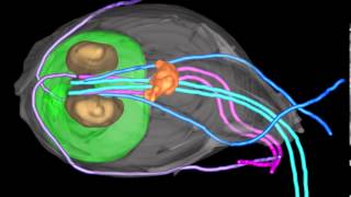 A Giardia trophozoite reconstructed by 3View Gatan Inc [upl. by Denn]