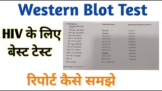 western blot test II Western blot report interpretation [upl. by Tristas178]