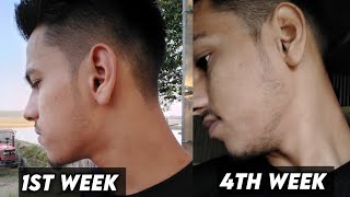 1 Month Use Minoxidil Beard Transformation  1 Month Results Minoxidil [upl. by Pearle601]