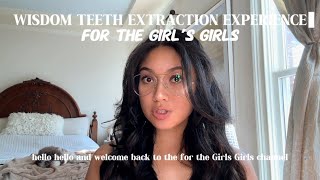 My Wisdom Teeth Extraction Experience [upl. by Eerased]