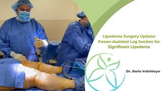 Lipedema Surgery Update PowerAssisted Leg Suction for Significant Lipedema  Dr Boris Volshteyn [upl. by Sillihp]