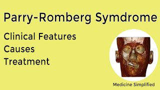 Parry Romberg Syndrome  Causes Symptoms Treatment and Clinical Features [upl. by Weil]