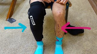 MTB KNEE PAD SHIN GUARD UNBOXING amp REVIEW  ION KPACT SELECT  Ep 39 [upl. by Lyrrad829]