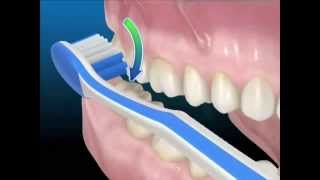 Guarda come spazzolare i tuoi denti e la lingua [upl. by Hastie]