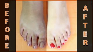 FEET WHITENING PEDICURE at home  Remove SUN TAN amp WHITEN YOUR SKIN [upl. by Annirtak]