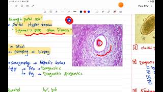 GIT PARA REV II Trematodes amp cestodes [upl. by Surbeck]