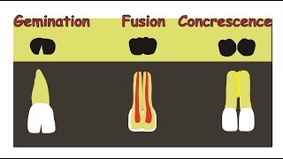 Fusion Gemination amp Concrescence [upl. by Annadal498]