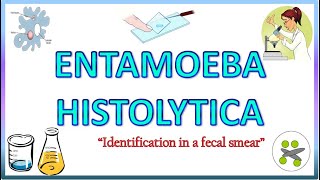 Entamoeba Histolytica  Morphology of the Trophozoite amp Cyst on Light Microscope Stools for AOC [upl. by Annad]