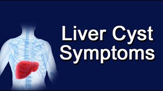 Liver Cyst Symptoms [upl. by Clere]