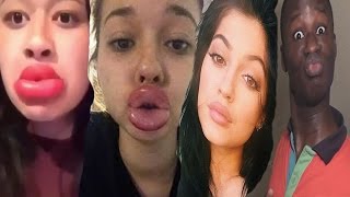 Kylie Jenner Lip Challenge Reaction [upl. by Liponis]