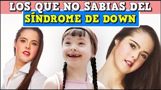 Sindrome de down  curiosidades que no sabias [upl. by Chester54]