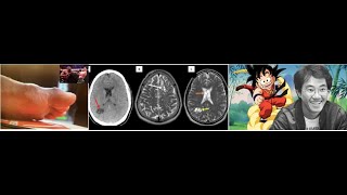 Défaite de Doumbé VERRE dans le pied mort de Toriyama CERVEAU homme avec VERS dans le CERVEAU [upl. by Kym]