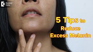 5 TIPS TO REDUCE EXCESS MELANIN  Reduce Melanin in Body PermanentlyDrDivya SharmaDoctors Circle [upl. by Timothee]