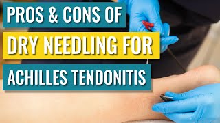 Dry Needling For Achilles Tendinopathy  Tendonitis — Does It Help [upl. by Bartolomeo]