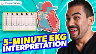 5 minute EKGECG Interpretation for NCLEXRN  Simplenursing [upl. by Goulden6]