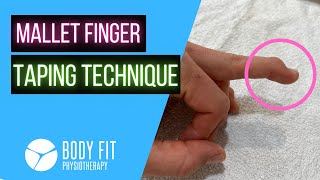 Mallet Finger I Taping Technique [upl. by Gadmon]