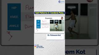 Dr Faheem Kotekar Explains Gait Patterns in Cerebral Palsy  Conceptual Orthopedics [upl. by Rausch352]