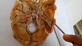 CONTENTS of pterygopalatine fossa PTERYGOPALATINE GANGLION simple explanation part 2 [upl. by Sillek]