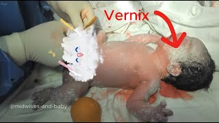 Do you know anything about the vernix layer of newborns [upl. by Eenattirb]