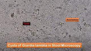 Stool Faeces Saline Wet Mount Preparation and Microscopy showing Giardia at various magnifications [upl. by Ablasor764]