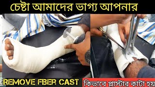 Remove cast fiber castOur Treatment [upl. by Adidnere787]