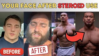 How you look AFTER steroids What steroids does to your face [upl. by Samid50]