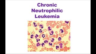 Chronic Neutrophilic Leukemia WHO 2022 [upl. by Mercie]