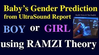 Baby boy symptoms during pregnancy from Ultrasound Report using Ramzi Theory in English [upl. by Chryste487]