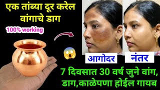 ना क्रीम ना पार्लर घरगुती पद्धतीने घालवा वांग आणि काळवटपणा 😱 kitchen tips  marathi kitchen  Tadka [upl. by Coit]