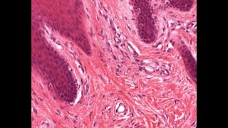 Connective Tissue proper histology [upl. by Perseus996]