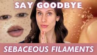 How To Get Rid Of Sebaceous Filaments [upl. by Fulmer]