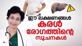 കരള്‍ രോഗം ശരീരം മുന്‍കൂട്ടി നല്‍കുന്ന അപായ ലക്ഷണങ്ങൾ  Fatty liver  Dr Jolly Thomson [upl. by Aniat193]