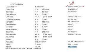 AULA 03 LEUCOGRAMA E PLAQUETOGRAMA [upl. by Kerk]