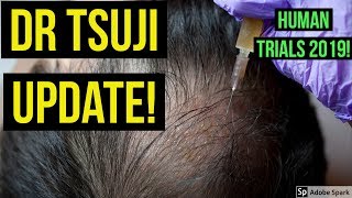 DR TAKASHI TSUJI UPDATE HUMAN TRIAL STARTING 2019 [upl. by Ashok]