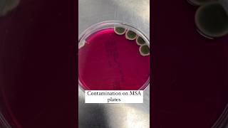 Contamination on MSA [upl. by Kilgore]