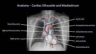 How to Interpret a Chest XRay Lesson 2  A Systematic Method and Anatomy [upl. by Eanel]