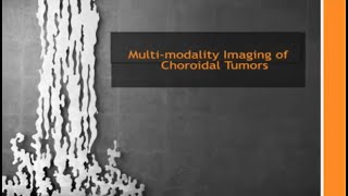 Multimodality Imaging of Eye Tumors How to Make the Diagnosis [upl. by Eed]