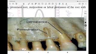 periodontology alveolar process مرحلة رابعة طب اسنان [upl. by Eidua216]