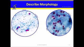 Cryptosporidium Intestinal coccidia [upl. by Eidoow]