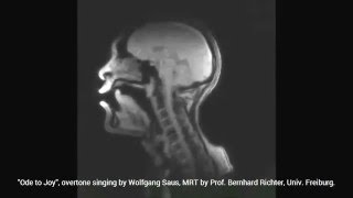 Beethoven quotOde to Joyquot with Overtone Singing MRI  see what happens inside the mouth [upl. by Nwahsal]