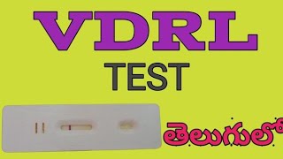 VDRL In TeluguVenereal disease research laboratory vdrl procedure Telugudmlteducation [upl. by Eidnar]