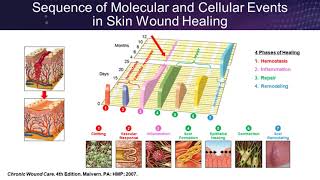 How Science Can Guide Practice Placental Based Allografts [upl. by Janetta]