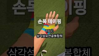 TFCC 삼각섬유연골복합체 에 대한 테이핑 스포츠테이핑 sportstaping 손목테이핑 wristtaping kinesiotaping tfcctaping tfcc [upl. by Veriee]