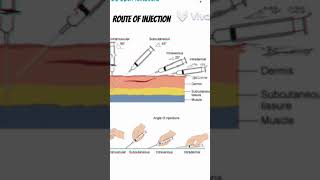 Different route of injection administration of drugs route injection shorts 3danimation viral [upl. by Konstanze]