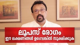 എന്താണ് ലൂപസ് രോഗം  SLE or Lupus Disease Malayalam Health Tips [upl. by Neall]