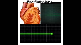 Heart Flatline Sound  Heart Sound heart heartsound health youtubeshorts medicalknowledge [upl. by Dreddy]